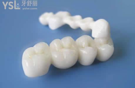 韓國DMAX諦美克思全瓷牙