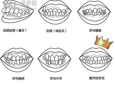 牙齒矯正