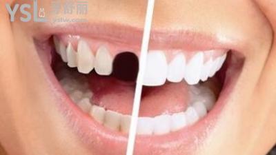 u=3339702706,597209812&fm=11&gp=0.jpg