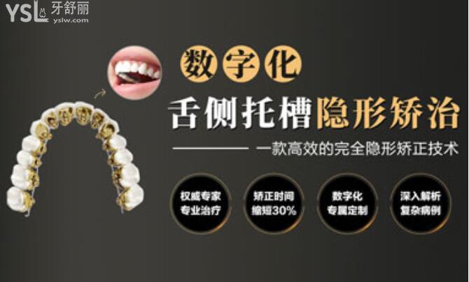 舌側(cè)隱形矯治
