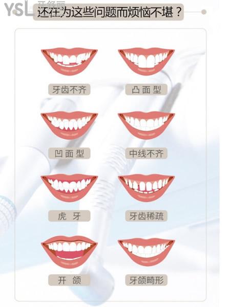 牙齒畸形