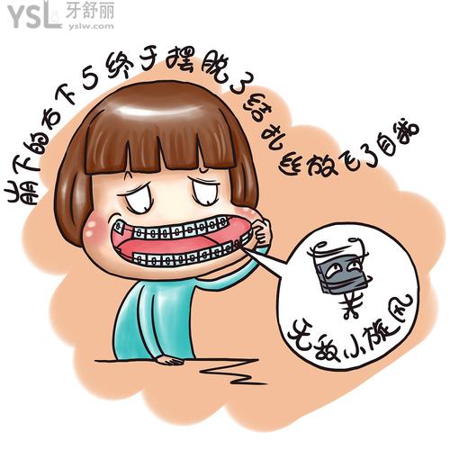 嘮嘮珠海牙齒矯正一般大概價(jià)格多少錢(qián)，包括珠海正畸哪家醫(yī)院好