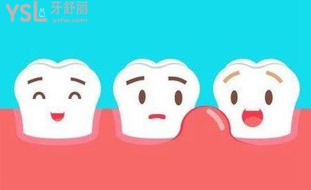 牙周炎導(dǎo)致牙齦萎縮怎么
