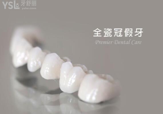 全瓷冠假牙