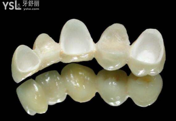 二氧化鋯全瓷牙