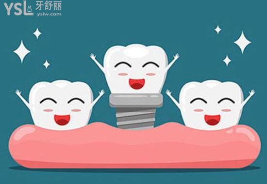 種植牙卡通配圖