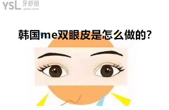 me雙眼皮是什么技術(shù)