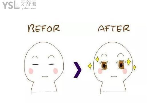 卡通配圖雙眼皮前后