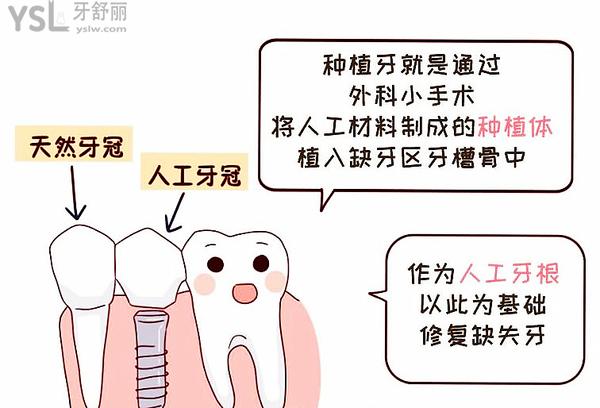 種植牙既然這么火，那種植牙人老了有沒有弊端？