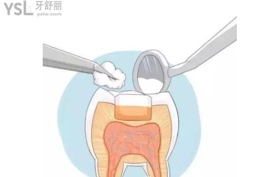 補牙卡通配圖