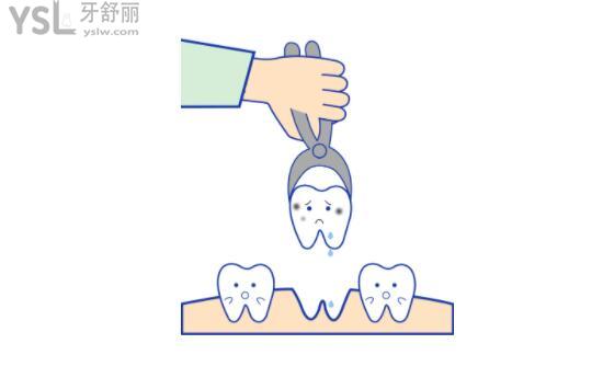 拔牙卡通配圖