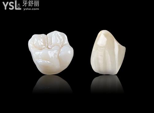 1000元的全瓷牙和1500的區(qū)別大嗎，3000元又如何？來看！