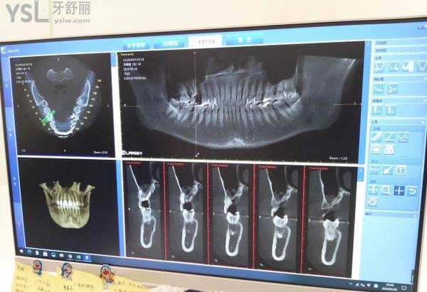 牙管家口腔醫(yī)院怎么樣4