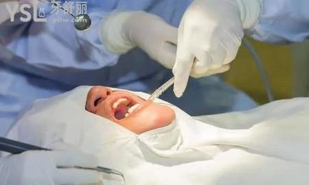 拔智齒后如何防止干槽癥