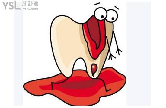 牙齦出血網(wǎng)絡配圖