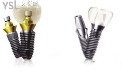 韓國登騰種植牙多少錢一顆，3900元一顆靠譜嗎？