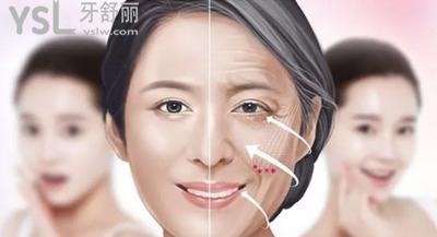 廣州聶云飛醫(yī)生做拉皮手術(shù)怎么樣？網(wǎng)友口碑實(shí)測！