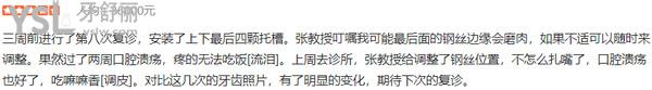 北京禾禾齒科口腔門診部正規(guī)靠譜嗎_地址_視頻_口碑好不好_收費(fèi)標(biāo)準(zhǔn)_能用社保嗎?(正規(guī)靠譜/北京市朝陽區(qū)/口碑非常好/收費(fèi)中等/暫不能用社保/教員醫(yī)生領(lǐng)銜/疑難牙齒矯正正畸/一城兩院)