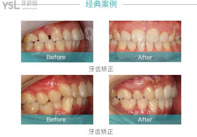 寧波恩吉口腔怎么樣