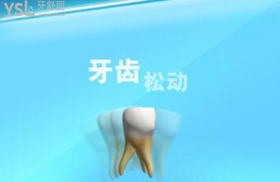 牙齒松動圖片