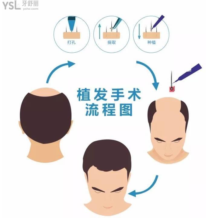 ?？谥舶l(fā)好的醫(yī)院有哪些