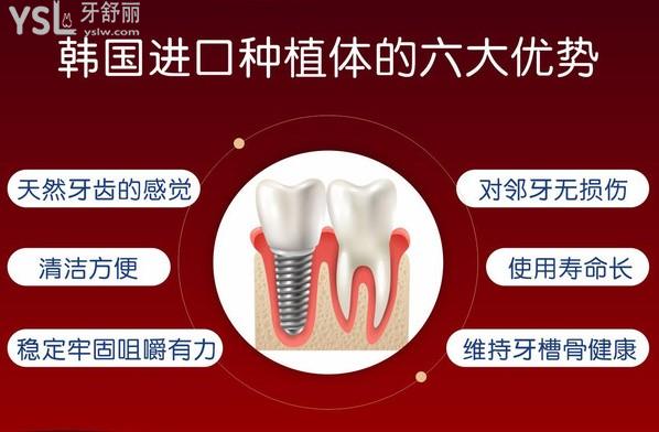 襄陽時(shí)代口腔種植牙優(yōu)勢