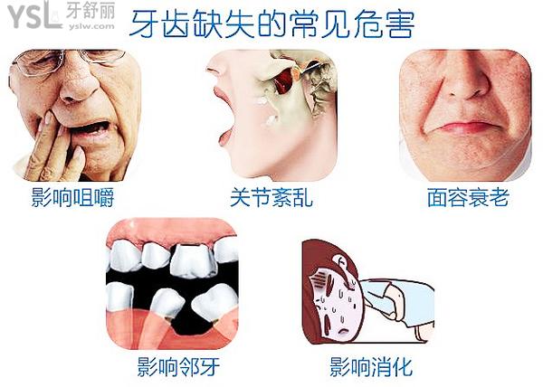 全口無牙怎么種植牙，來看答案