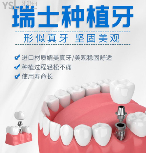 種假牙是韓國好還是瑞士的好