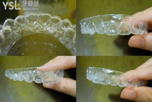 隱形矯正材料有哪些