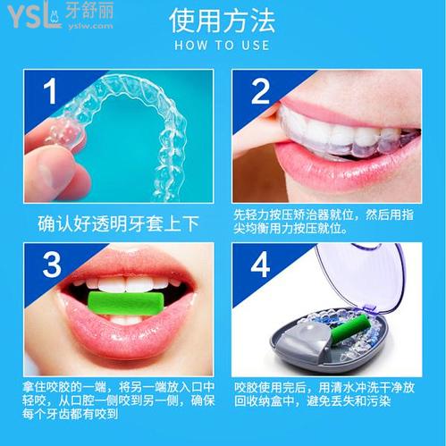 隱形矯正注意事項(xiàng)