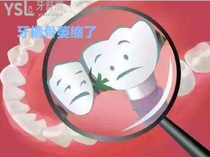 你的牙槽骨萎縮了嗎？