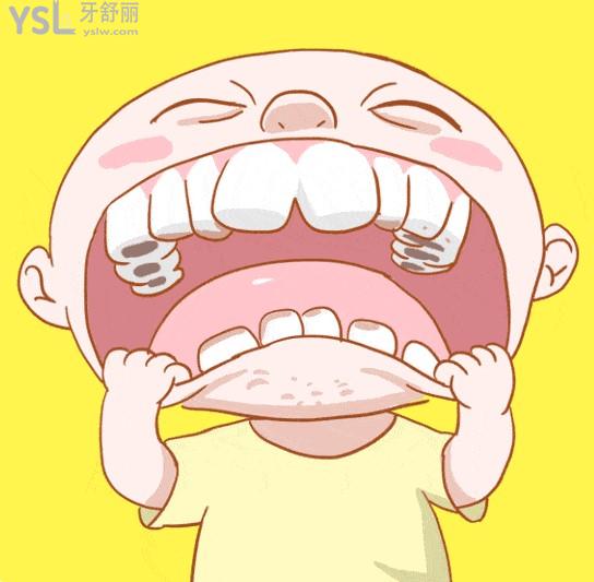 齲齒