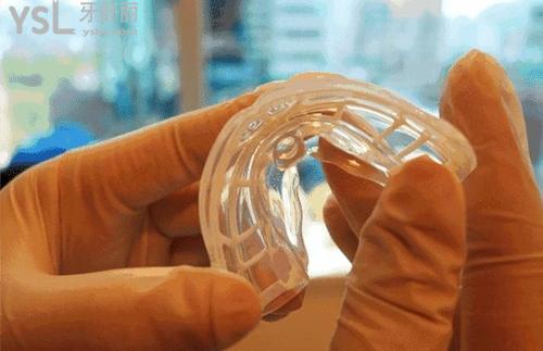 兒童mrc矯正器適合的年齡和成效情況怎么樣？牙醫(yī)揭開謎團