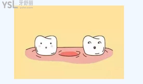 缺失一顆牙