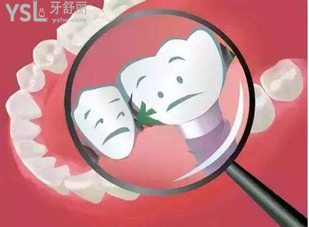 種植牙出血怎么處理