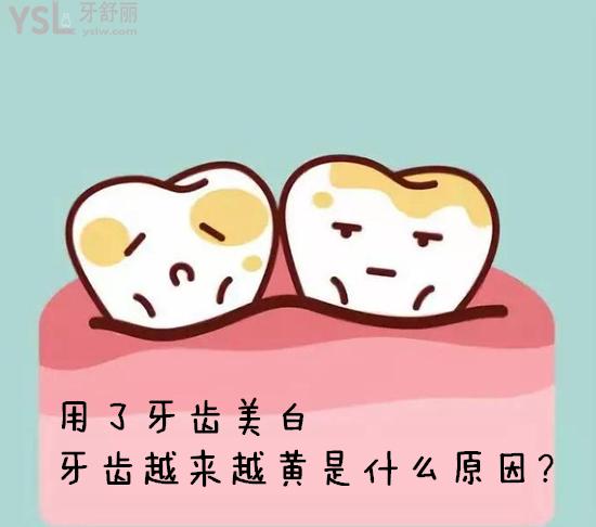 牙齒越來越黃是什么原因？