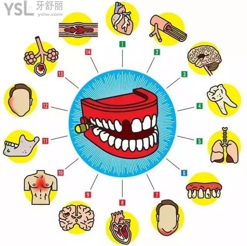 細數(shù)中年人牙齒容易爛是什么原因2