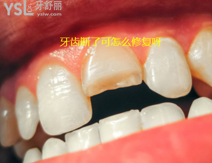 牙齒被打斷怎么修復(fù)