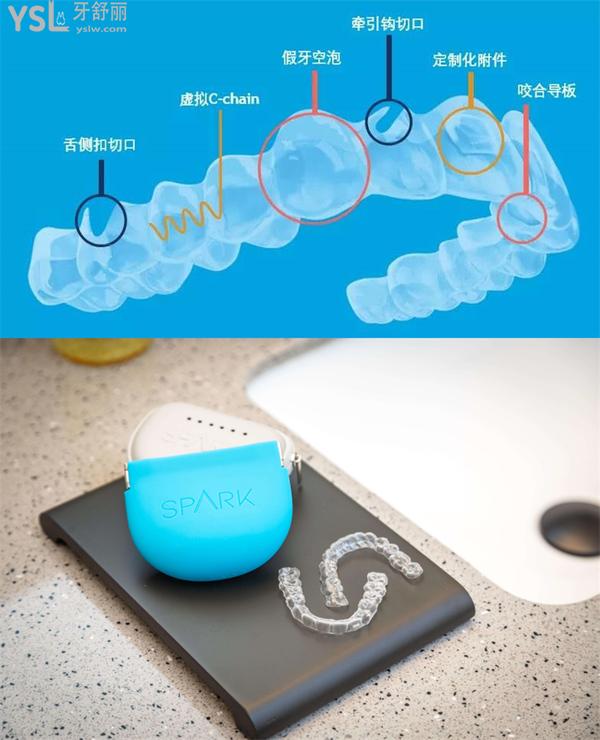 上海維樂口腔門診部正規(guī)靠譜嗎_地址_視頻_口碑好不好_收費(fèi)標(biāo)準(zhǔn)_能用嗎?(一城20院/碩博醫(yī)生領(lǐng)銜)