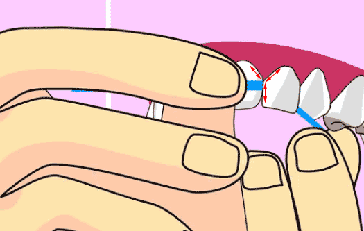 牙線正確使用方法3