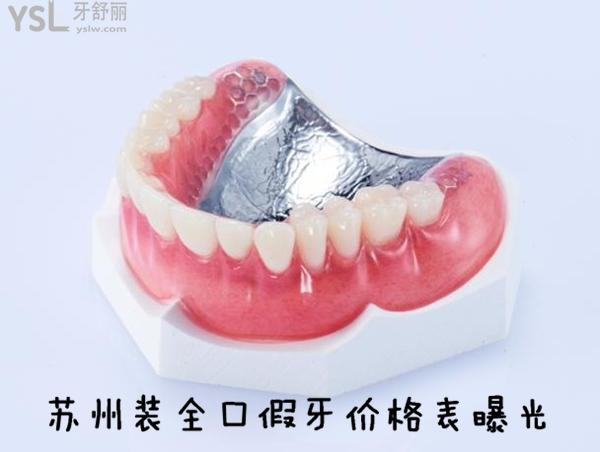 蘇州裝全口假牙價格表