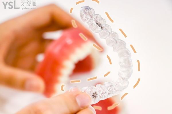 怎么選擇牙齒矯正器,金屬自鎖-隱形-舌側(cè)-陶瓷-單晶中選哪個