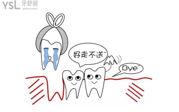 后牙拔除
