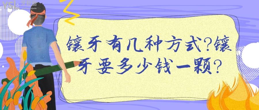 鑲牙有幾種方式?鑲牙要多少錢一顆?