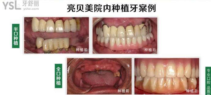 杭州亮貝美口腔醫(yī)院收費(fèi)貴不貴 .jpg