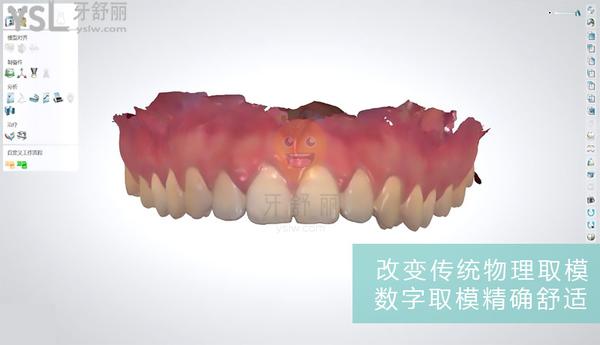 青島維樂(lè)口腔醫(yī)院3D技術(shù)
