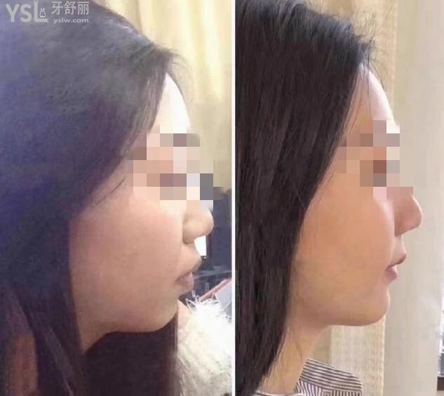 2021年格萊美口腔醫(yī)院價(jià)目表 網(wǎng)友反饋正畸技術(shù)較好 .jpg