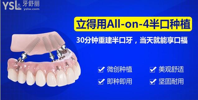 立得用ALL-ON-4半口種植