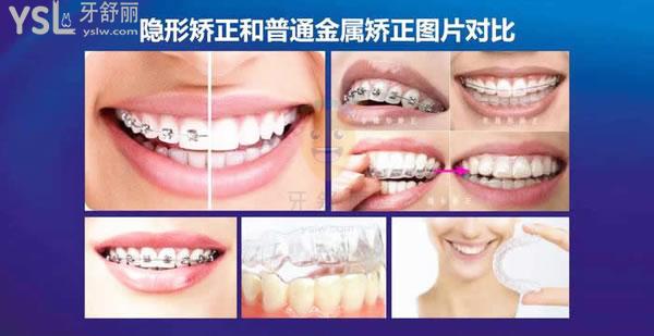 桂林周瑾帆口腔牙齒矯正怎么樣