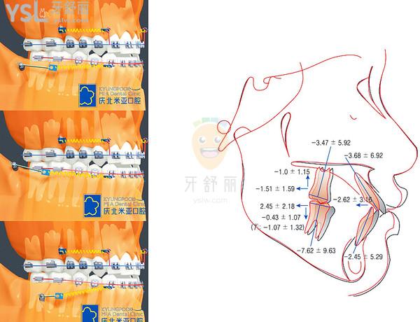 北京慶北米亞口腔矯正優(yōu)勢